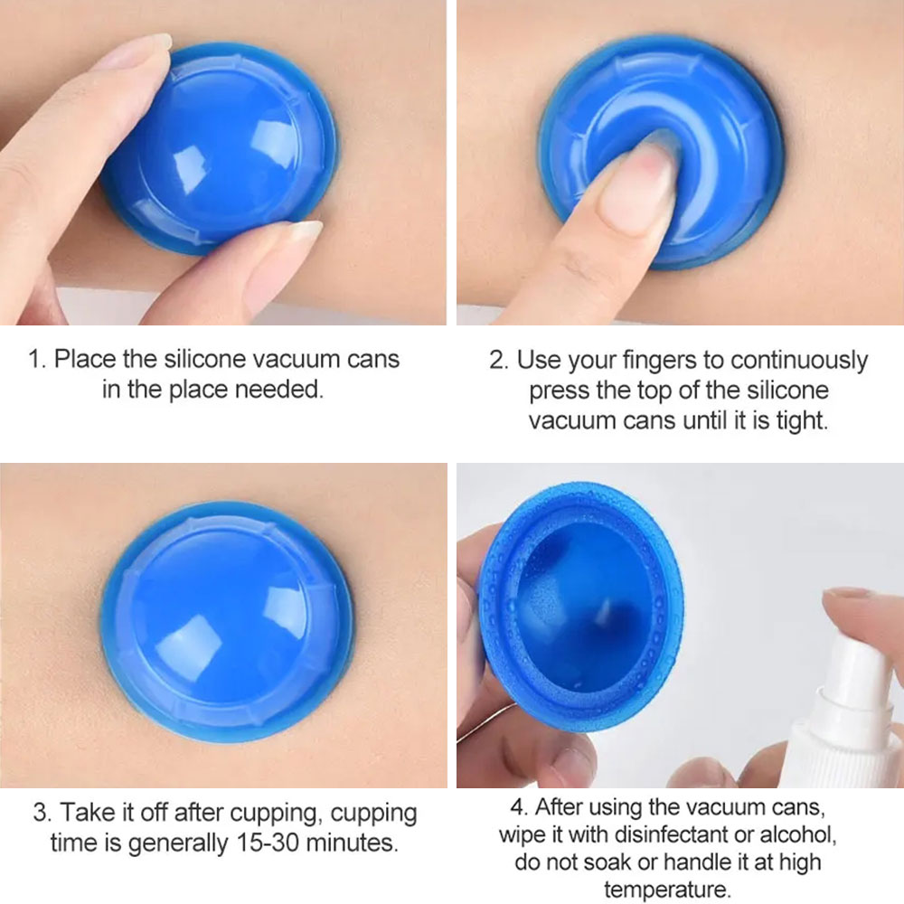 Mangkuk hisap silikon 12 buah, - Cupping Therapy Set ulasan dan harga