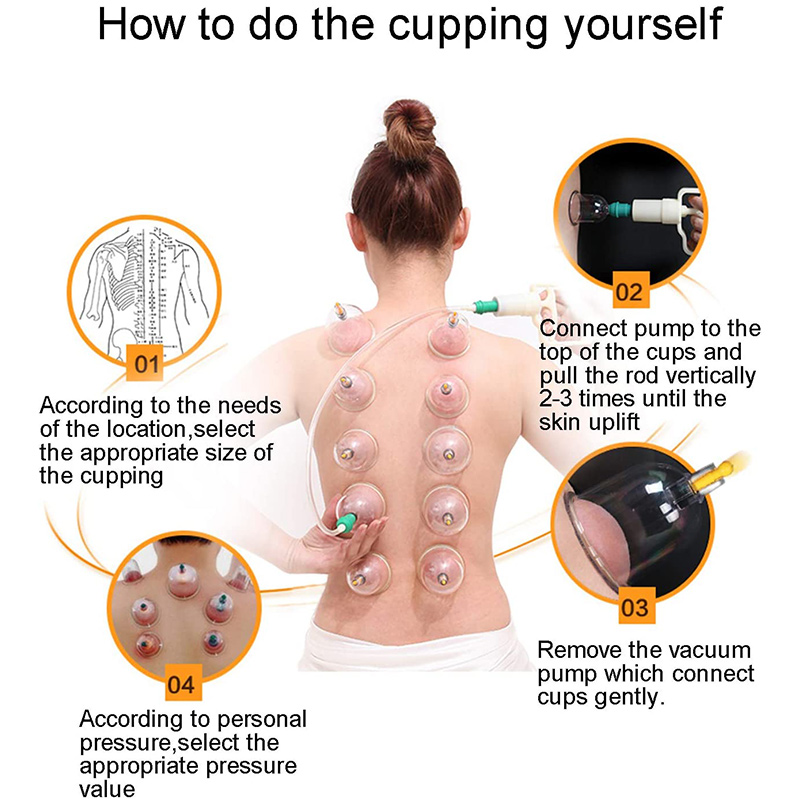 Mangkuk penyedot vakum pijat 6 - Cupping Therapy Set ulasan dan harga